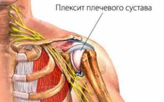 Что делать, если болит плечо правой или левой руки?