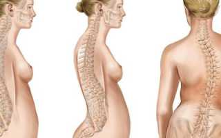 Болит спина в области поясницы: причины и чем лечить