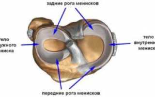 Дегенеративные повреждения латерального и медиального менисков коленного сустава