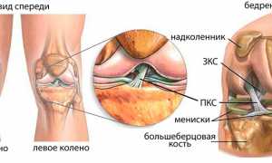 Повреждение передней или задней крестообразной связки коленного сустава